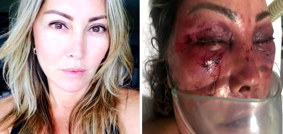 Elaine Perez Caparroz antes e depois das agressÃµes â?? Foto: ReproduÃ§Ã£o/TV Globo