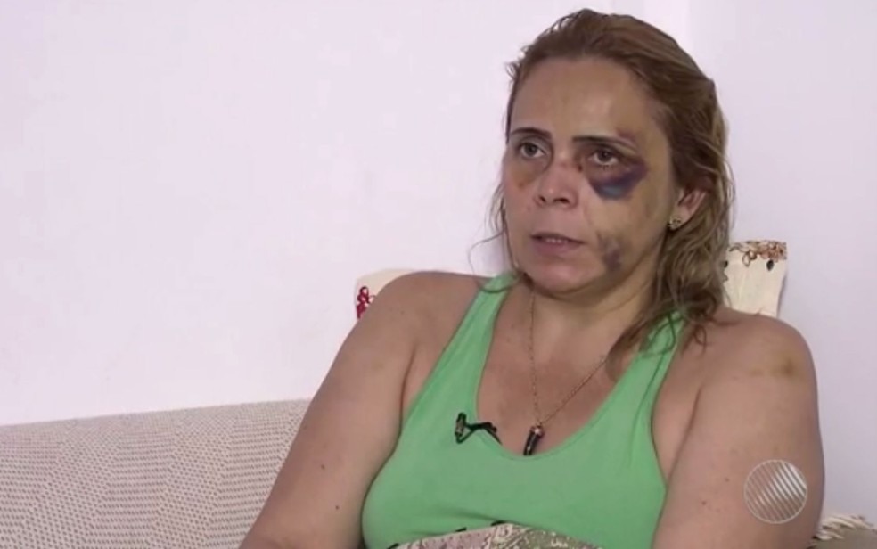 Alexandra do Nascimento denunciou que sofreu agressões do ex-namorado, o humorista Renato Fechine (Foto: Reprodução/TV Bahia)