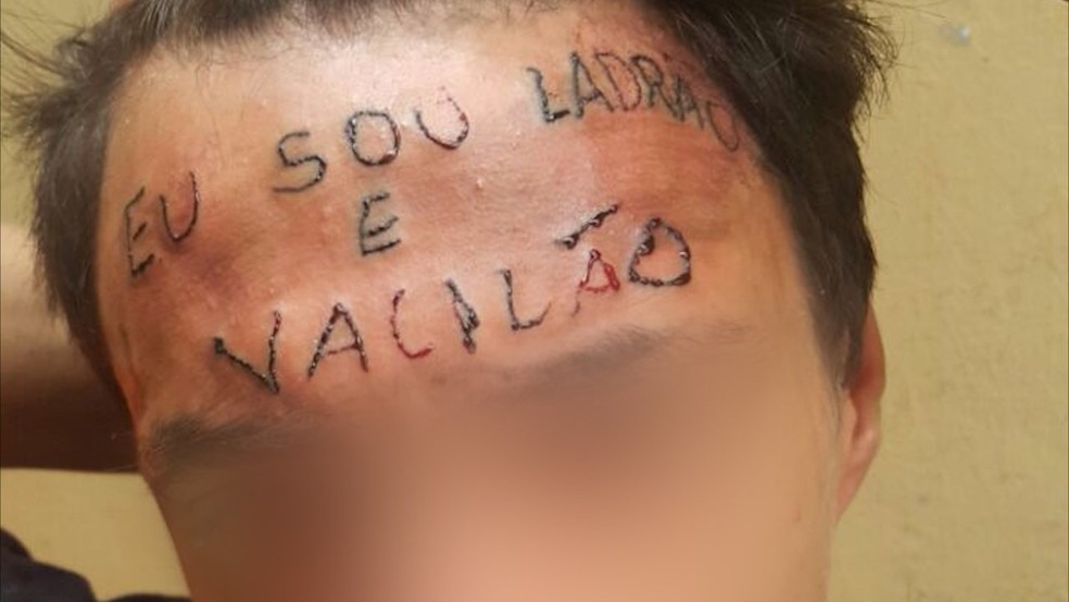 Garoto teve a testa tatuada no início do mês  (Foto: Reprodução)