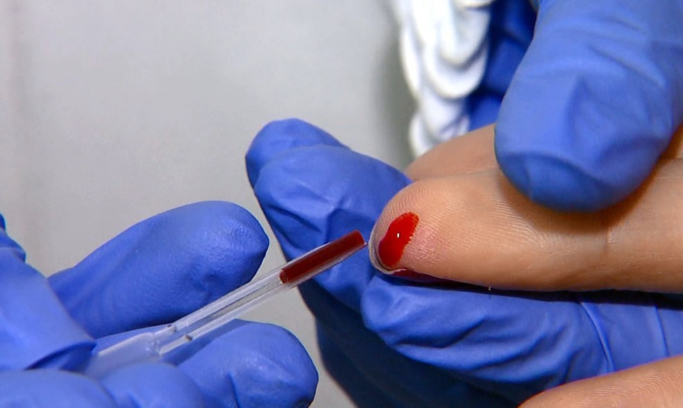 Testes rápidos são oferecidos para quem apresentar sintomas das condições  (Foto: Reprodução EPTV)