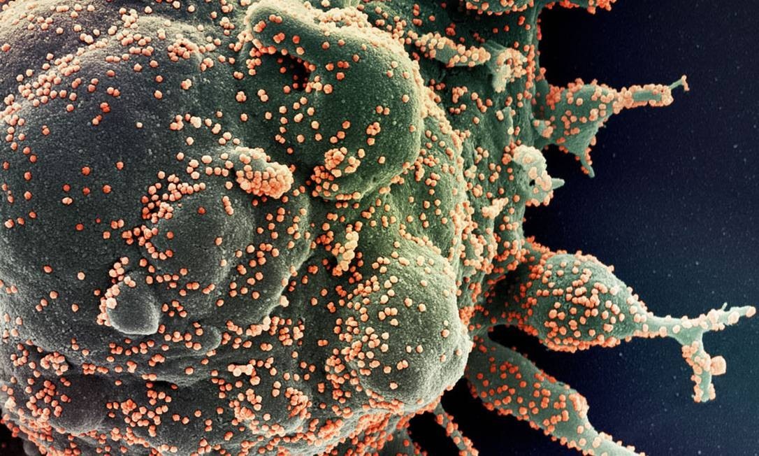 A imagem do novo coronavírus divulgada pela NASA nesta terça-feira (2) foi produzida pelo Instituto Nacional de Alergia e Doenças Infecciosas dos Estados Unidos (NIAID). Foto: NIAID / NASA