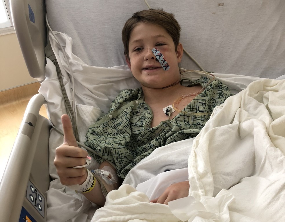 Xavier Cunningham estÃ¡ se recuperando no hospital apÃ³s passar por cirurgia para remoÃ§Ã£o do objeto que atravessou sua cabeÃ§a â?? Foto: Shannon Miller/ Family Photo/ AFP